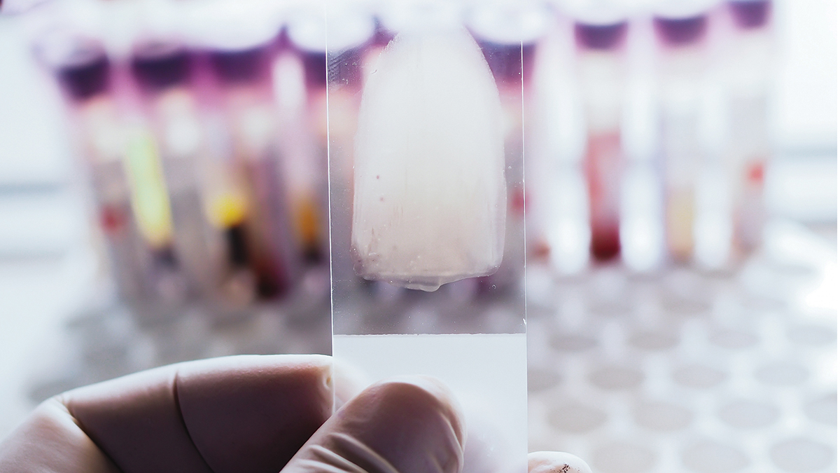 Making Sense of Sickle Cell Disease