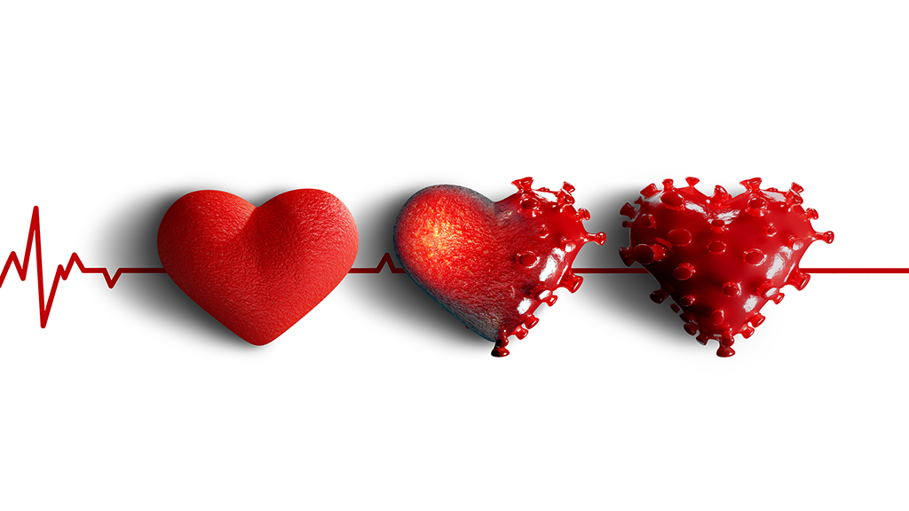 Coronavirus Quandaries for Patients with Cardiovascular Disease