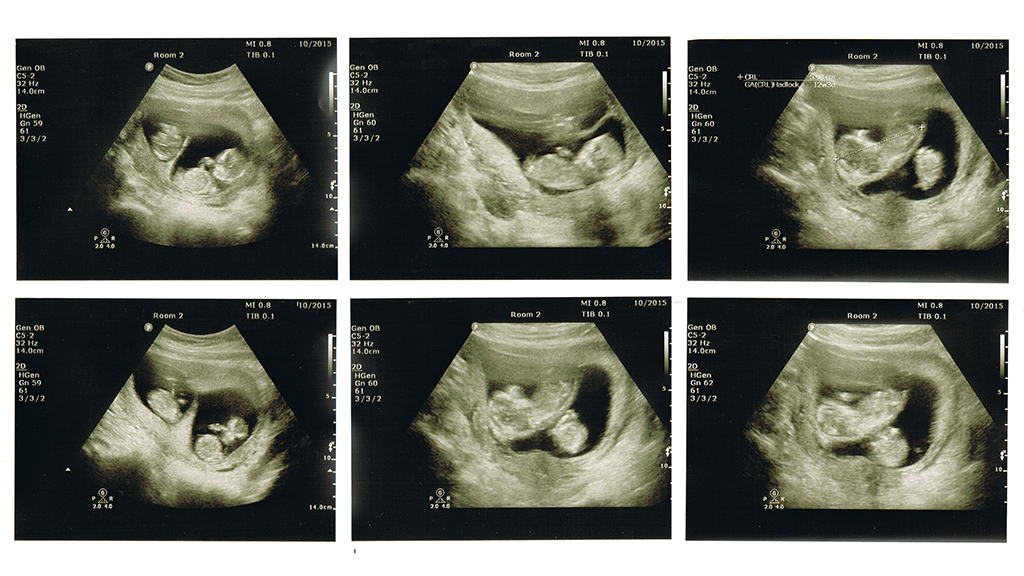 Anyone Who Had a Heart