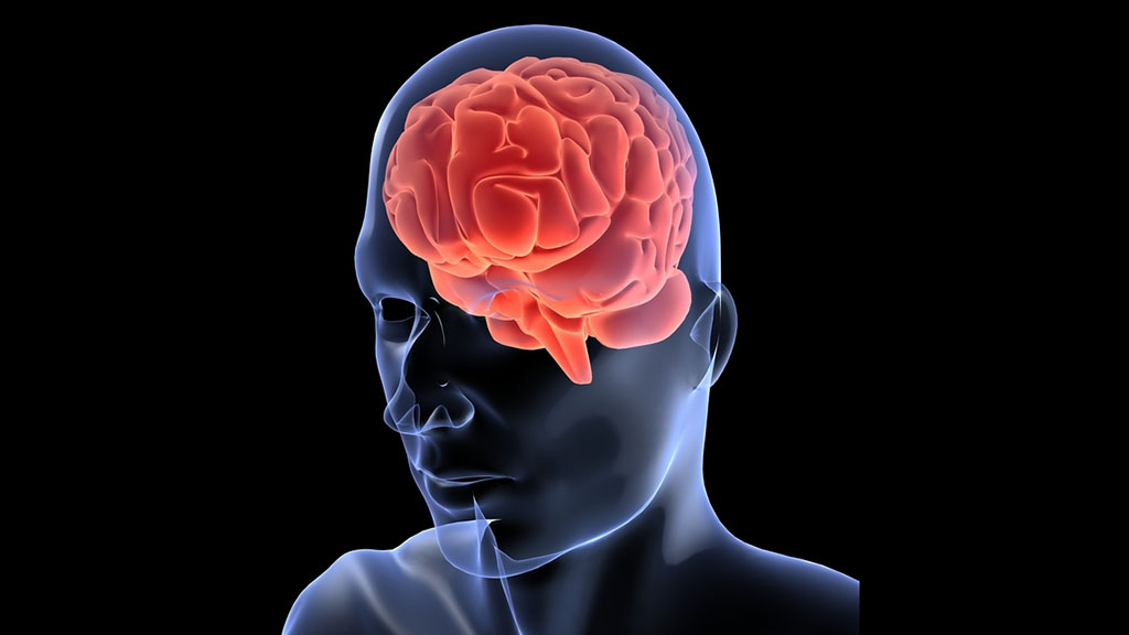 Mini Cases in Movement Disorders