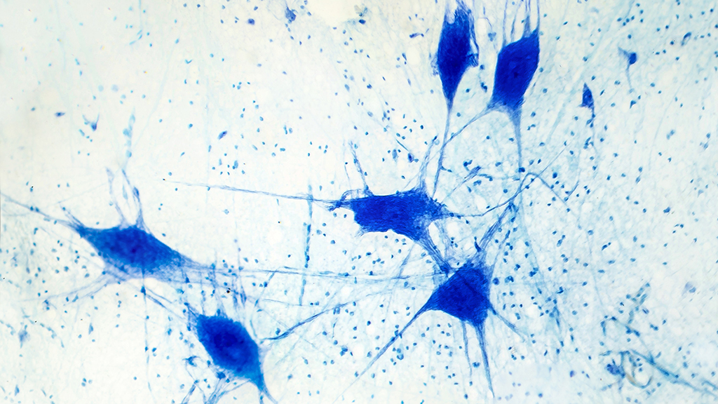 The Case of the Malfunctioning Neuron