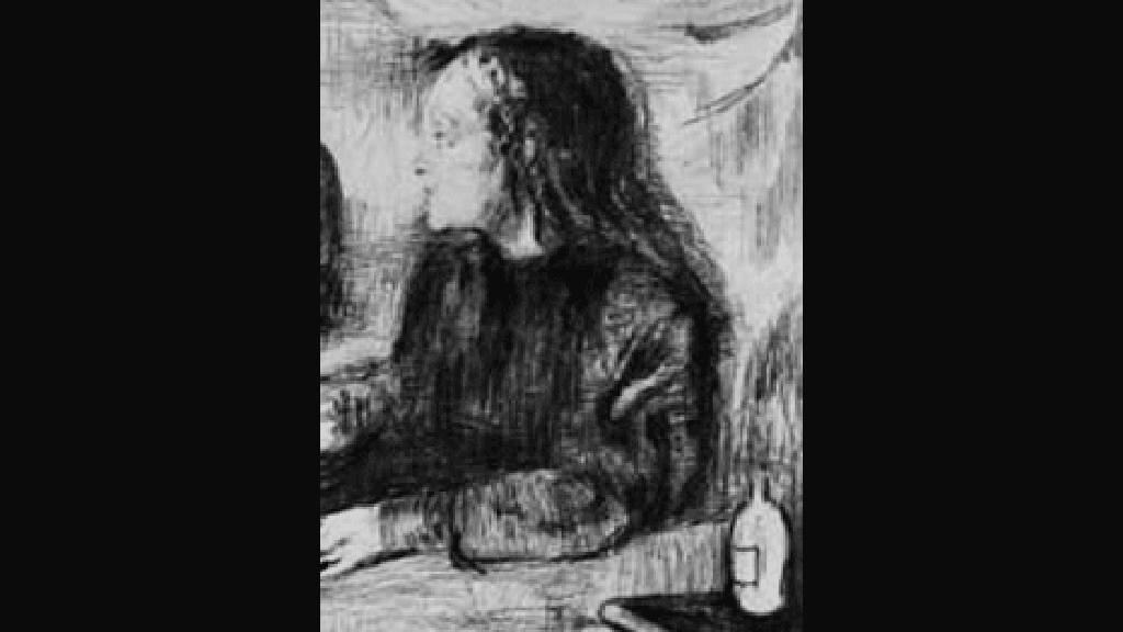 A Case of Diabetes Insipidus