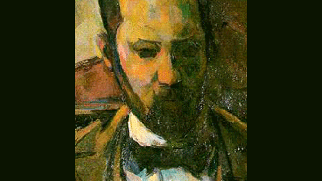 A Case of a Pheochromocytoma