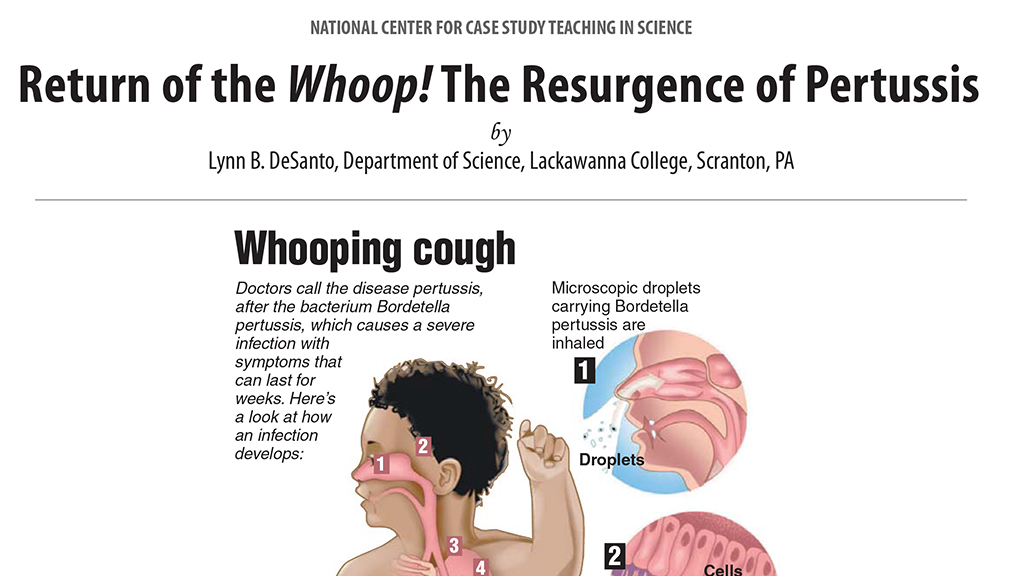 Return of the Whoop! NSTA