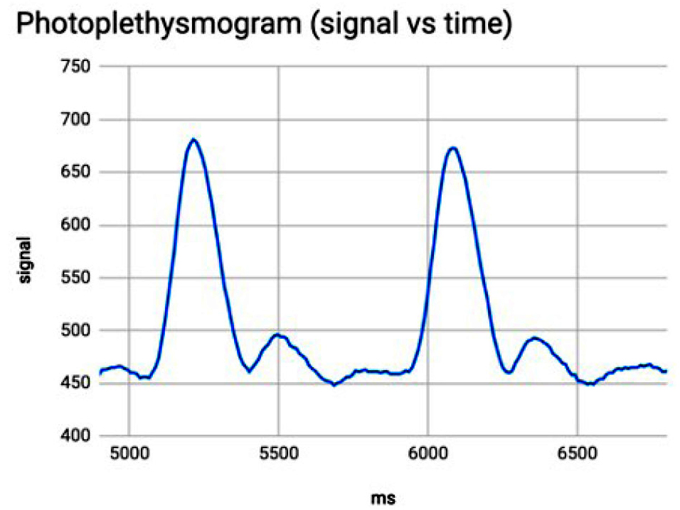 PPG plot from spreadsheet software.