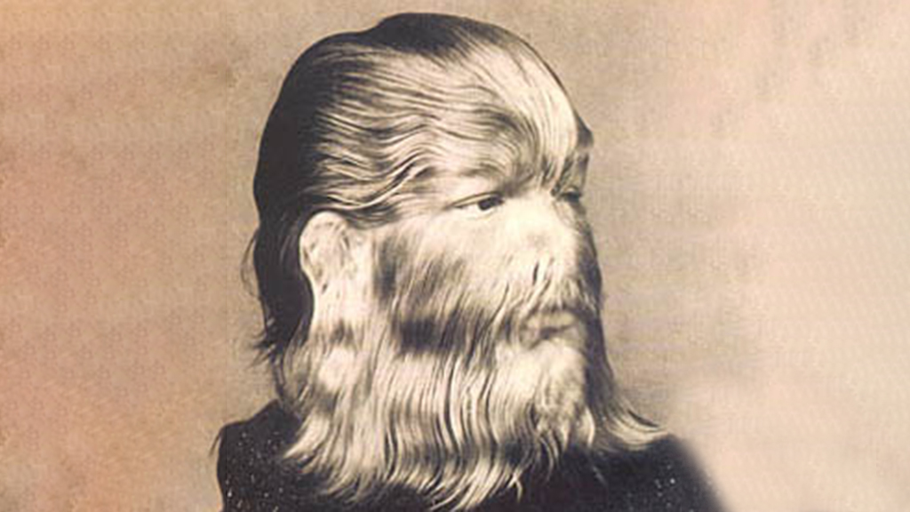 The "Wolfman" and the Chromosomal Basis of Heredity | NSTA