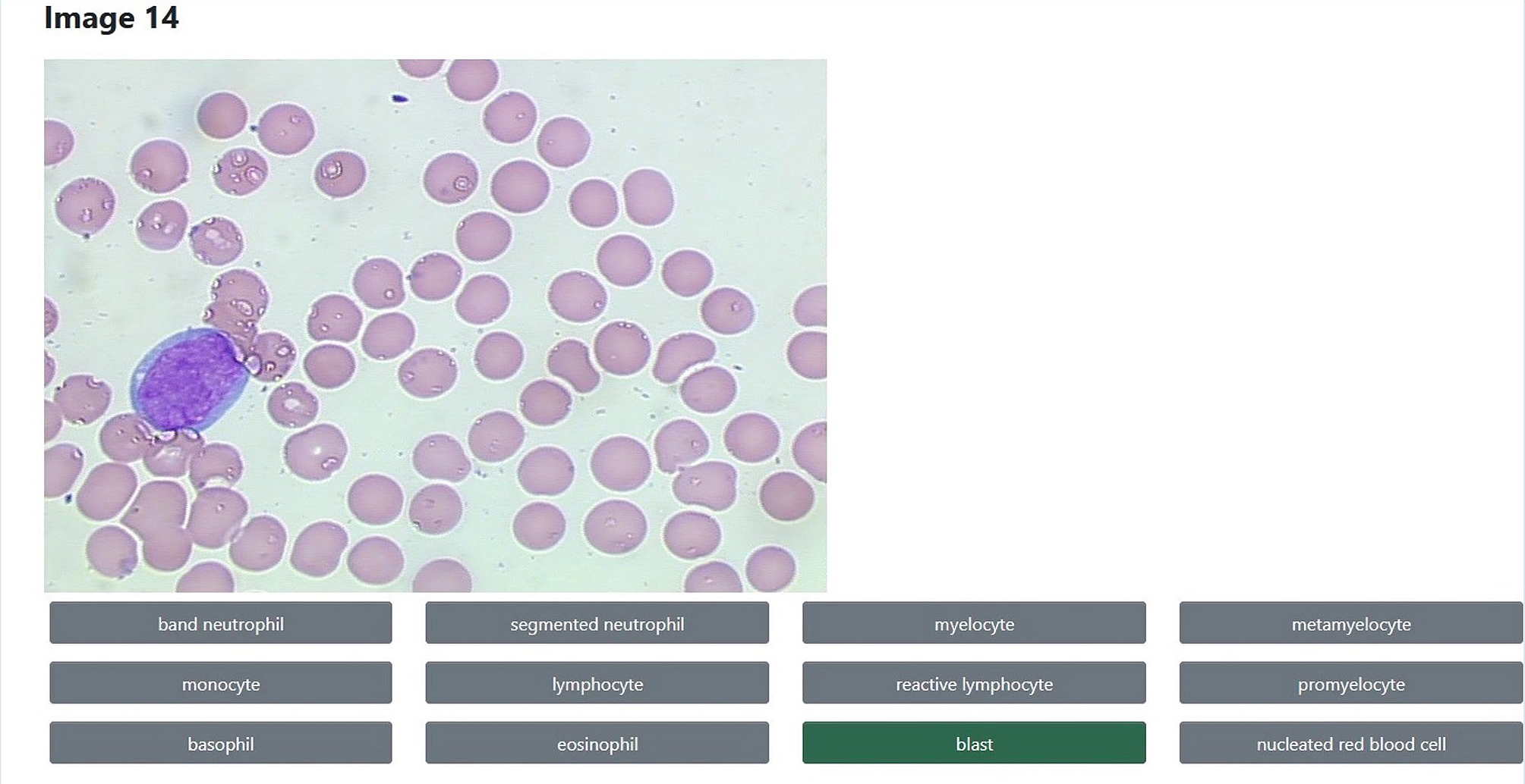 MediaLab white blood cell identification example. 