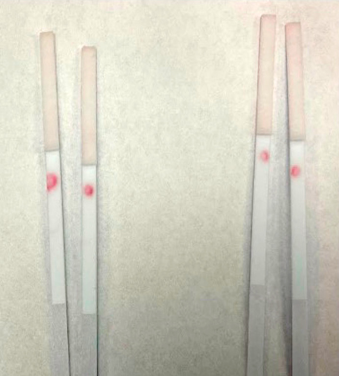 Half-strips run with cardiac troponin antibodies I and J in the presence of 200 ng/ml troponin protein (right) and absence of troponin (left).