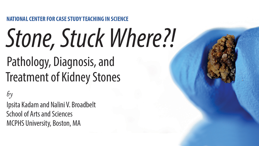 Stone, Stuck Where?!