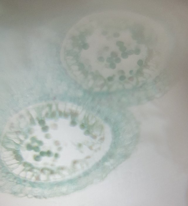 Pictures of commercially prepared lilium anther (pollen) were taken using a mobile device attached to the Foldscope.