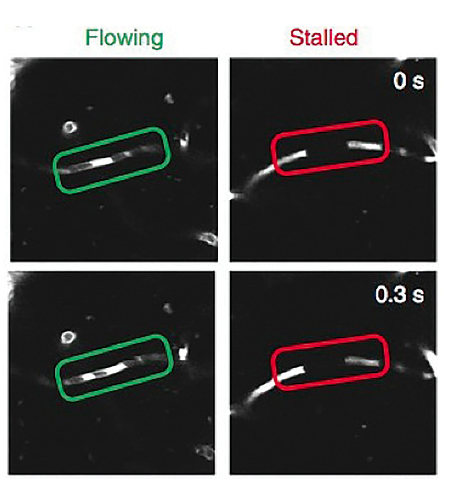 Figure 1 Images from the Stall Catchers game: Flowing vs. Stalled comparison.