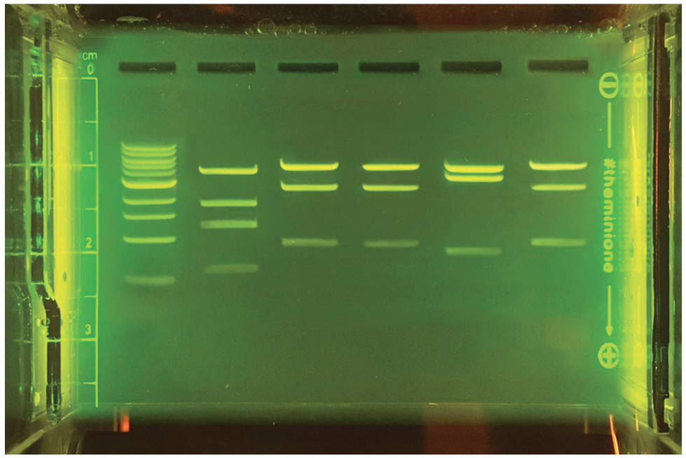 Figure 5  Gel electrophoresis picture.  From left to right: DNA Ladder, case study individual’s DNA sample, crime scene samples 1-4.